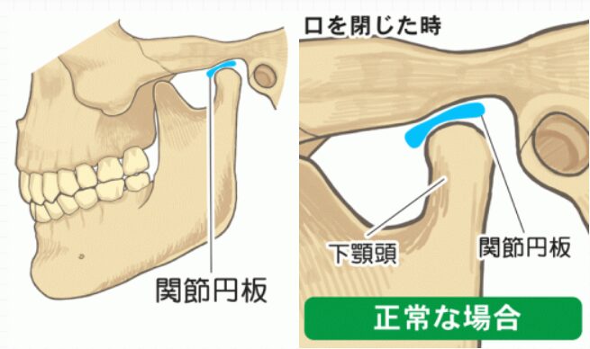 顎関節とかみしめのお話
