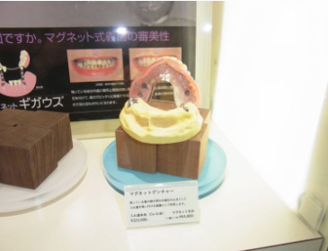 入れ歯